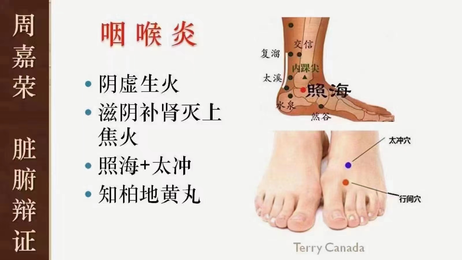 周嘉荣 宗筋疗法